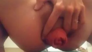 Prolapse presentation